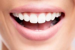 بلیچینگ یا کامپوزیت؟ کدام راه حل لبخند شماست؟
